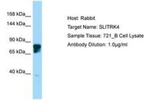 Image no. 1 for anti-SLIT and NTRK-Like Family, Member 4 (SLITRK4) (AA 661-710) antibody (ABIN6750228)