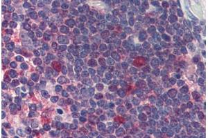 Thymus, Human: Formalin-Fixed, Paraffin-Embedded (FFPE) (CDK1 antibody)