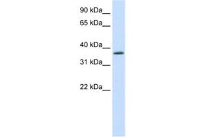 Western Blotting (WB) image for anti-SAP30 Binding Protein (SAP30BP) antibody (ABIN2461840) (SAP30BP antibody)