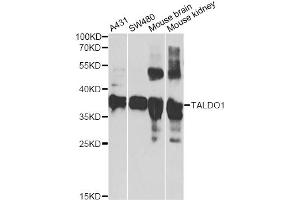 Western blot analysis of extracts of various cell lines, using TALDO1 antibody (ABIN2560291) at 1:1000 dilution. (TALDO1 antibody)