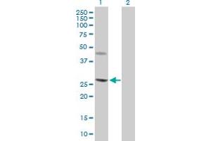 Western Blot analysis of CERK expression in transfected 293T cell line by CERK MaxPab polyclonal antibody. (CERK antibody  (AA 1-201))