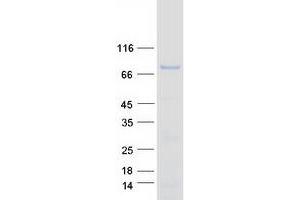 Western Blotting (WB) image for Forkhead Box O1 (FOXO1) protein (Myc-DYKDDDDK Tag) (ABIN2721365)
