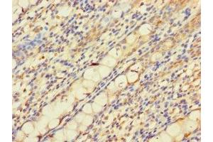 Immunohistochemistry of paraffin-embedded human colon tissue using ABIN7162692 at dilution of 1:100 (PNPLA2 antibody  (AA 1-504))