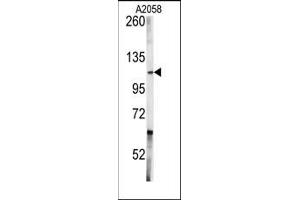 Image no. 1 for anti-C-Abl Oncogene 1, Non-Receptor tyrosine Kinase (ABL1) (Middle Region) antibody (ABIN359968)