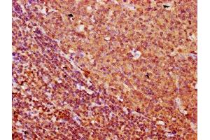 IHC image of ABIN7153151 diluted at 1:500 and staining in paraffin-embedded human tonsil tissue performed on a Leica BondTM system.