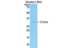 Western Blotting (WB) image for anti-Interleukin 17 Receptor A (IL17RA) (AA 590-848) antibody (ABIN1859358) (IL17RA antibody  (AA 590-848))