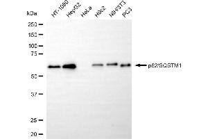 Western blotting analysis using p62/SQSTM1 antibody (ABIN7800298). (Recombinant SQSTM1 antibody)