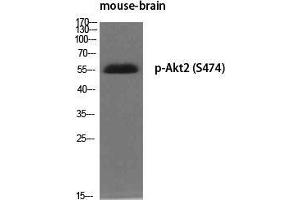 Western Blot (WB) analysis of specific cells using Phospho-Akt2 (S474) Polyclonal Antibody. (AKT2 antibody  (pSer474))