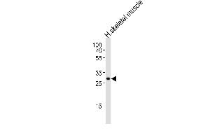 Western blot analysis of lysate from human skeletal muscle tissue lysate, using GBAS Antibody (Center) (ABIN6242358 and ABIN6577592).