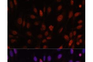 Immunofluorescence analysis of U-2 OS cells using HOXB1 Polyclonal Antibody at dilution of 1:100. (HOXB1 antibody)