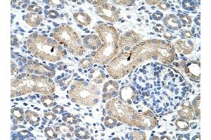 RBM38 antibody was used for immunohistochemistry at a concentration of 4-8 ug/ml to stain Epithelial cells of renal tubule (arrows) in Human Kidney.