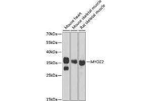 Western blot analysis of extracts of various cell lines, using MYOZ2 antibody (ABIN6129772, ABIN6144299, ABIN6144300 and ABIN6222126) at 1:1000 dilution.