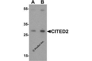 Western Blotting (WB) image for anti-Cbp/p300-Interacting Transactivator, with Glu/Asp-Rich Carboxy-terminal Domain, 2 (CITED2) (N-Term) antibody (ABIN1077387) (CITED2 antibody  (N-Term))