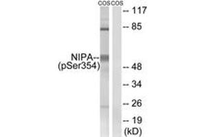 Western blot analysis of extracts from COS7 cells treated with HU 2nM 24h, using NIPA (Phospho-Ser354) Antibody. (ZC3HC1 antibody  (pSer354))