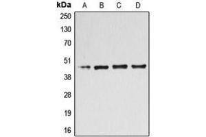Western blot analysis of B4GALT3 expression in Jurkat (A), HL60 (B), HeLa (C), COLO205 (D) whole cell lysates. (B4GALT3 antibody  (Center))