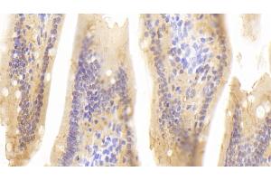 Detection of RBP2 in Mouse Small intestine Tissue using Polyclonal Antibody to Retinol Binding Protein 2, Cellular (RBP2) (RBP2 antibody  (AA 1-134))