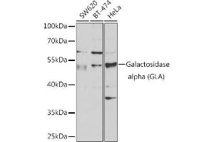 Western blot analysis of extracts of various cell lines, using Galactosidase alpha (Galactosidase alpha (GLA)) antibody (ABIN6131511, ABIN6141114, ABIN6141116 and ABIN6218799) at 1:1000 dilution. (GLA antibody  (AA 150-429))
