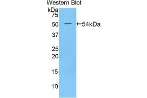 Western blot analysis of the recombinant protein. (WNT10A antibody  (AA 108-343))