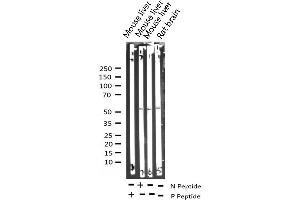 Western Blotting (WB) image for anti-Tumor Protein P53 (TP53) (pSer15) antibody (ABIN6256151)