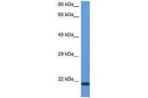 WB Suggested Anti-CD70 AntibodyTitration: 1. (CD70 antibody  (N-Term))