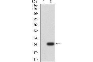 Western blot analysis using UCP3 mAb against HEK293 (1) and UCP3 (AA:1-113 and 217-312)-hIgGFc transfected HEK293 (2) cell lysate. (UCP3 antibody  (AA 1-113, AA 217-312))