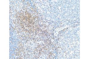 Immunohistochemistry (IHC) image for anti-CD28 (CD28) (AA 170-220) antibody (ABIN7455122) (Recombinant CD28 antibody  (AA 170-220))