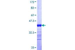 CLCA1 Protein (AA 677-776) (GST tag)