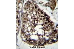 TBCEL Antibody (C-term) immunohistochemistry analysis in formalin fixed and paraffin embedded human testis tissue followed by peroxidase conjugation of the secondary antibody and DAB staining. (TBCEL antibody  (C-Term))