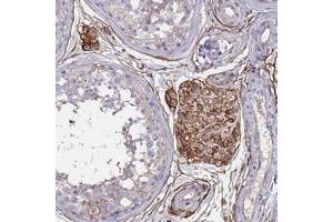 Immunohistochemical staining of human testis with ABCA8 polyclonal antibody  shows strong cytoplasmic and membranous positivity in Leydig cells at 1:50-1:200 dilution. (ABCA8 antibody)