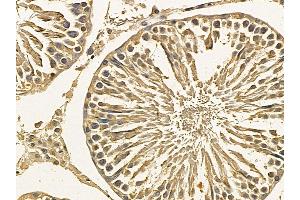 TNF Receptor II Mouse Monoclonal Antibody at 1/100 staining rat testis tissue by IHC-P.