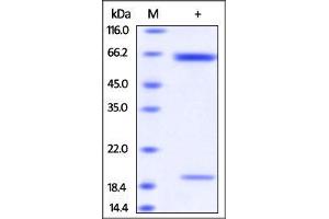 Rat PCSK9, His Tag on SDS-PAGE under reducing (R) condition. (PCSK9 Protein (AA 31-691) (His tag))
