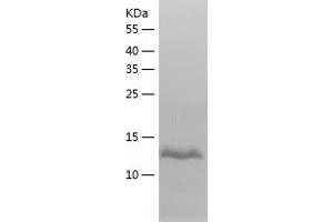 Western Blotting (WB) image for L-2-Hydroxyglutarate Dehydrogenase (L2HGDH) (AA 65-216) protein (His tag) (ABIN7288867) (L2HGDH Protein (AA 65-216) (His tag))