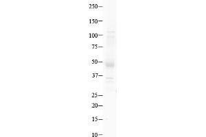 Host:  Rabbit  Target Name:  GSH2  Sample Type:  Human Testis   Antibody Dilution:  1. (GSX2 antibody  (N-Term))