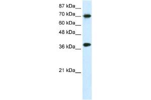 WB Suggested Anti-TCEA1 Antibody Titration:  0. (TCEA1 antibody  (N-Term))