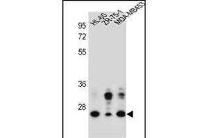 GFRA4 Antibody (Center) (ABIN657173 and ABIN2837905) western blot analysis in HL-60,ZR-75-1,MDA-M cell line lysates (35 μg/lane). (GFRA4 antibody  (AA 156-184))