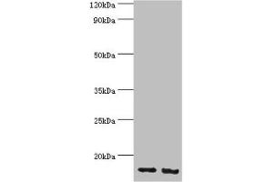 Western blot All lanes: E3 ubiquitin-protein ligase RBX1 antibody at 4 μg/mL Lane 1: Hela whole cell lysate Lane 2: HepG2 whole cell lysate Secondary Goat polyclonal to rabbit IgG at 1/10000 dilution Predicted band size: 12 kDa Observed band size: 12 kDa (RBX1 antibody  (AA 1-108))