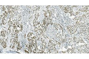 IHC analysis of IL37 using anti-IL37 antibody (ABIN7601794). (IL-37 antibody  (AA 46-218))