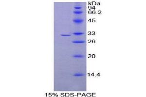 SDS-PAGE (SDS) image for Programmed Cell Death 1 Ligand 2 (PDCD1LG2) (AA 21-268) protein (His tag) (ABIN1879023) (PDCD1LG2 Protein (AA 21-268) (His tag))