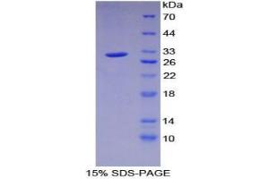 SDS-PAGE analysis of Human PRKAg1 Protein.
