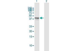 Western Blot analysis of LAG3 expression in transfected 293T cell line by LAG3 MaxPab polyclonal antibody. (LAG3 antibody  (AA 1-360))