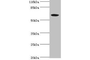 Western blot All lanes: SLC13A4 antibody at 2 μg/mL + 293T whole cell lysate Secondary Goat polyclonal to rabbit IgG at 1/10000 dilution Predicted band size: 69 kDa Observed band size: 69 kDa (SLC13A4 antibody  (AA 134-273))