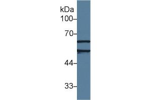 Western Blot; Sample: Human Jurkat cell lysate; Primary Ab: 1µg/ml Rabbit Anti-Rat AchE Antibody Second Ab: 0. (Acetylcholinesterase antibody  (AA 157-332))