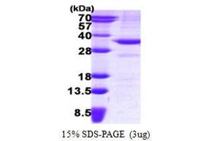 SDS-PAGE (SDS) image for 3-hydroxybutyrate Dehydrogenase, Type 1 (BDH1) (AA 47-343) protein (His tag) (ABIN7279653) (BDH1 Protein (AA 47-343) (His tag))