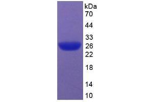 SDS-PAGE analysis of Rat Caspase 9 Protein. (Caspase 9 Protein)