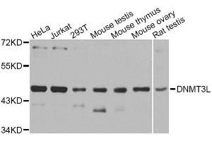 Western blot analysis of extracts of various cell lines, using DNMT3L antibody. (DNMT3L antibody  (AA 151-386))