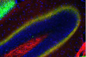 Immunostaining of a PFA fixed mouse hippocampus section with anti-Doc2a/b (dilution 1 : 200; red) and Oyster® 650 labeled anti-calretinin (cat. (Doc 2a/b (AA 1-403) antibody)