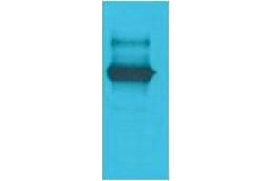 Western Blotting (WB) image for anti-LexA DNA Binding Region antibody (ABIN3179078)