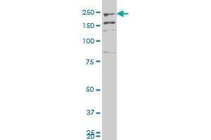 FER1L3 polyclonal antibody (A01), Lot # 060529JCS1. (Myoferlin antibody  (AA 655-754))