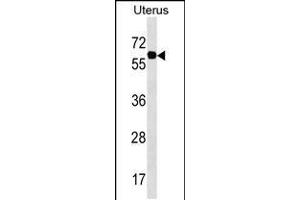 Western blot analysis in Uterus tissue lysates (35ug/lane). (Phosphoglucomutase 3 antibody  (AA 237-263))