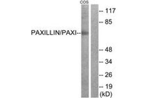 Western Blotting (WB) image for anti-Paxillin (PXN) (AA 15-64) antibody (ABIN2889052) (Paxillin antibody  (AA 15-64))
